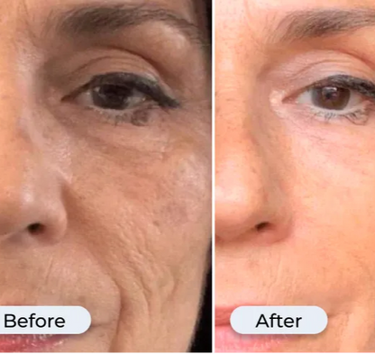 Korven No.9 NAD+ BIO Lifting Serum