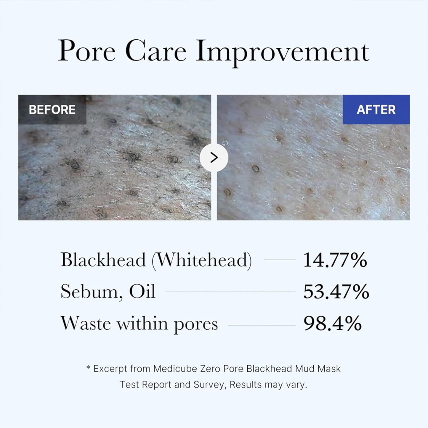 Korven Zero Pore Detox Mud Mask
