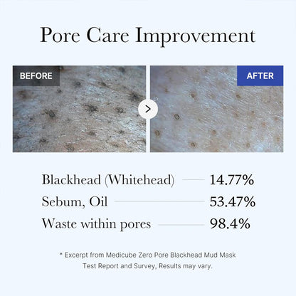 Korven Zero Pore Detox Mud Mask