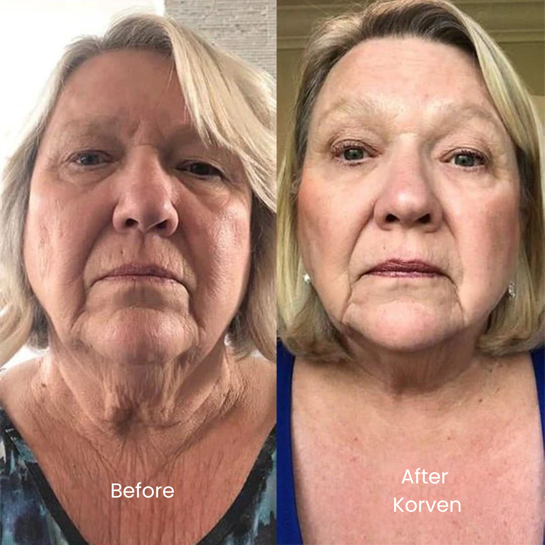 Korven No.9 NAD+ BIO Lifting Serum