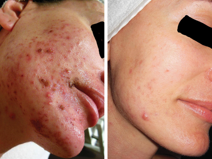 Korven Rice Glow Milky Toner