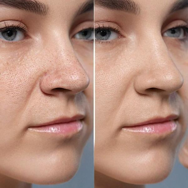 Korven Zero Pore Detox Mud Mask