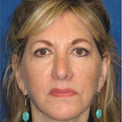Laura H.