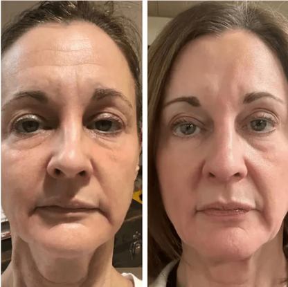 Korven Vita A Retinal Shot™