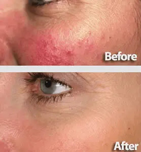 Korven Rice Glow Milky Toner